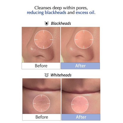liv.reome MSM Sulfur Deep Pore Cleanser – Low pH Barrier-Respecting Face Wash, Pore Reset for Sensitive Skin