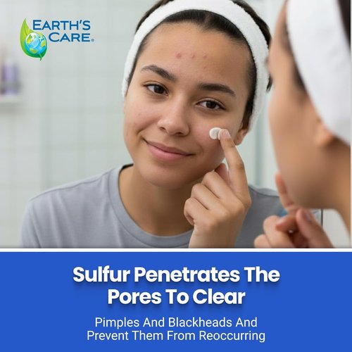 Earth's Care Acne Treatment Mask - 5% Sulfur Formula for Cystic Acne - 2.5 OZ Tube for Clear Skin