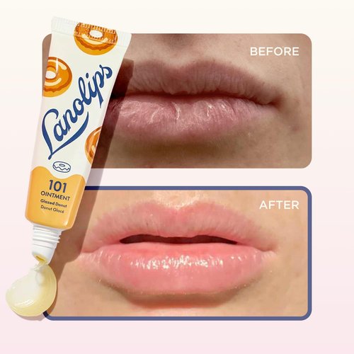 Lanolips 101 Ointment - Lanolin Lip Balm for Smooth, Hydrated & Healthy Lips - Multipurpose Lip Ointment with Lanolin Oil for Dry Lips, Cuticles & More - Glazed Donut (0.52 oz)