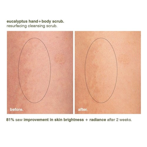 MALIN+GOETZ Eucalyptus Hand & Body Scrub - Resurfacing Cleanser with Lactic Acid & Niacinamide | Vegan, 8.5 Fl Oz