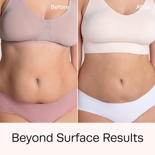 Hot Vita Slimdown Body Gel - Skin-Firming & Anti-Cellulite Formula for Full-Body Contouring & Improved Skin Appearance - Skin Firming & Body Sculpting Gel - Made with Natural, Skin-Safe Ingredients