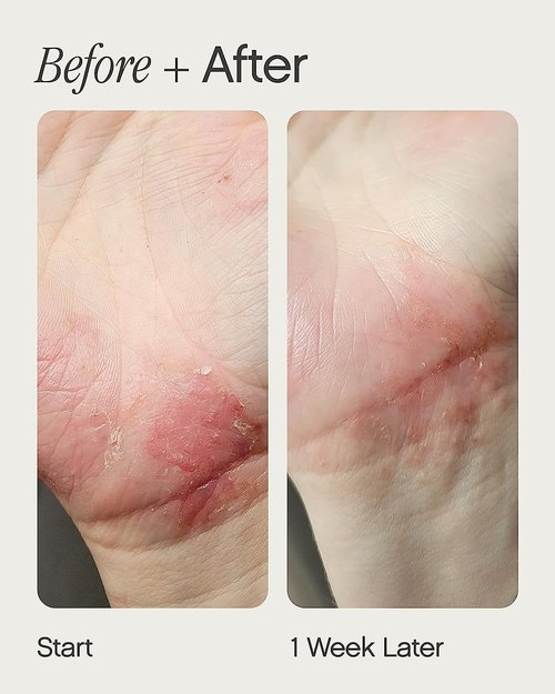 Topicals Like Butter Moisturizer - Soothing Relief for Dry, Sensitive & Eczema-Prone Skin | Hydrating Face & Body Cream (1.7 Fl Oz)