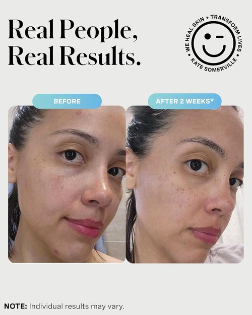 Kate Somerville EradiKate Acne Treatment Cleanser - 3% Sulfur Daily Foaming Face Wash, 4 Fl Oz