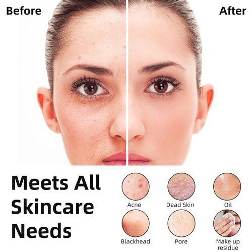Facial Cleansing Brush Portable Waterproof Rechargeable Face Wash Brush, Electric Deep Cleaning for Men & Women (Black)