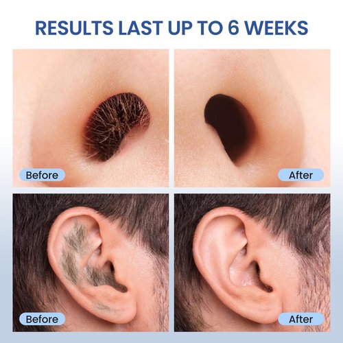 AUZEAL Nose Hard Wax Beads Refill for Men, Nose and Ear Hair Removal, Gentle & Precision Waxing for Sensitive Skin, Portable Home & Travel Wax Beads Only, 100g/3.53oz