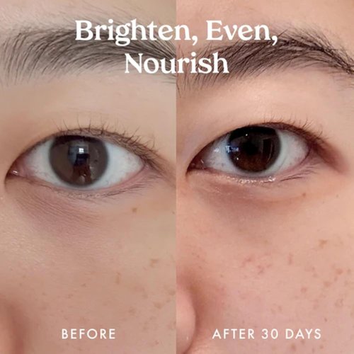 Kopari Ceramide & Retinol Eye Balm - Hydrating Anti-Aging Treatment for Fine Lines & Puffiness with Squalane