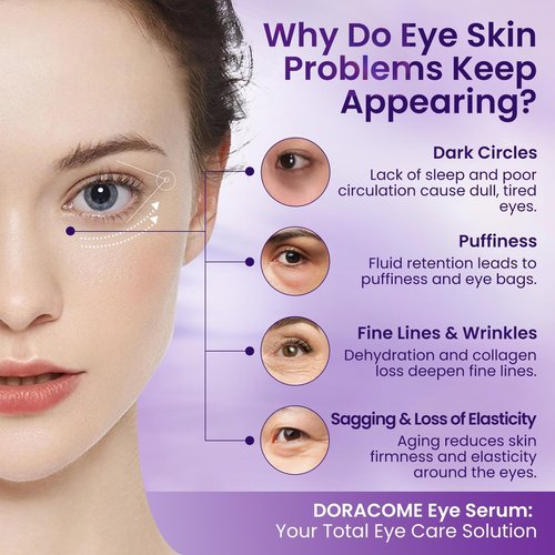 Doracome Caffeine & Retinol Under Eye Serum – Dermatologist-Tested, Fast Absorbing, Correction for Puffy Eye Bags Fine Lines Dark Circles Wrinkles While Providing Moisturizing Care