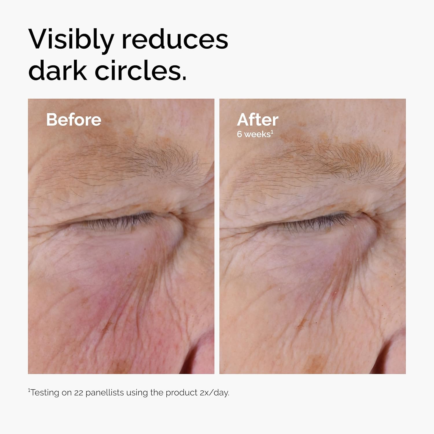 The Ordinary Caffeine Solution 5% + EGCG - Depuffing Eye Serum for Dark Circles & Tired Eyes