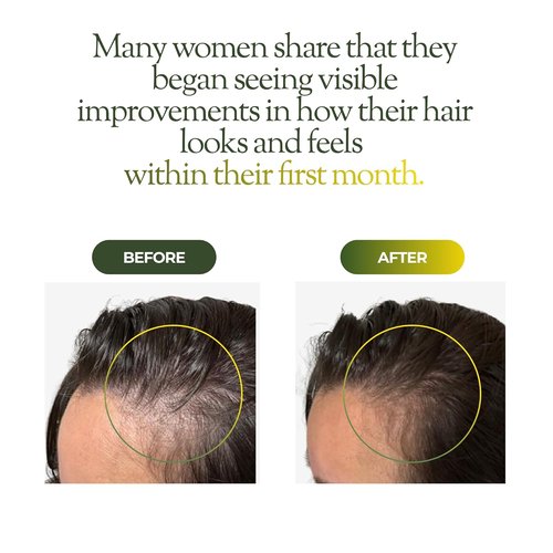 Regener8 Hair & Scalp Oil for Women - Natural Essential Oil Blend for Thinning Hair & Loss | Hormone Support