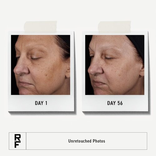 Rodan + Fields Reverse Deep Exfoliating Cleanser | 125 mL | Daily Facial Scrub with Glycolic Acid and AHAs
