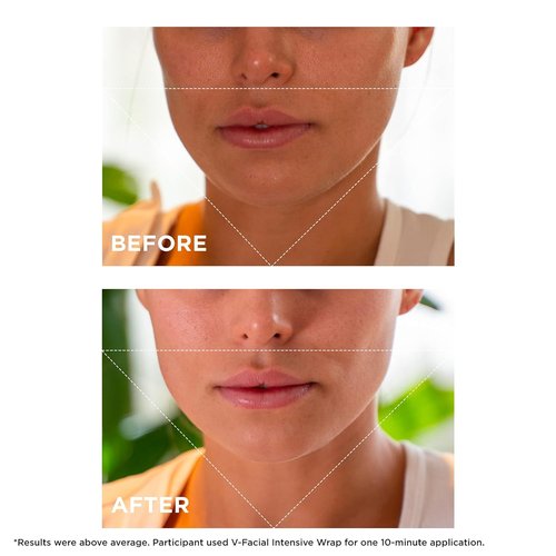 Clarins V-Facial Intensive Wrap Face Mask - Award-Winning Contouring Mask for Puffiness Relief | 2.5 Oz