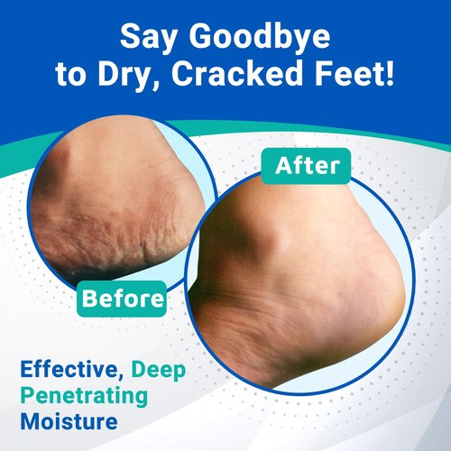 Dermal Therapy Heel Care Cream - Moisturizing Treatment that Repairs and Heals Dry, Rough, Cracked Heels and Feet (3 oz / 90g) - Pack of 2
