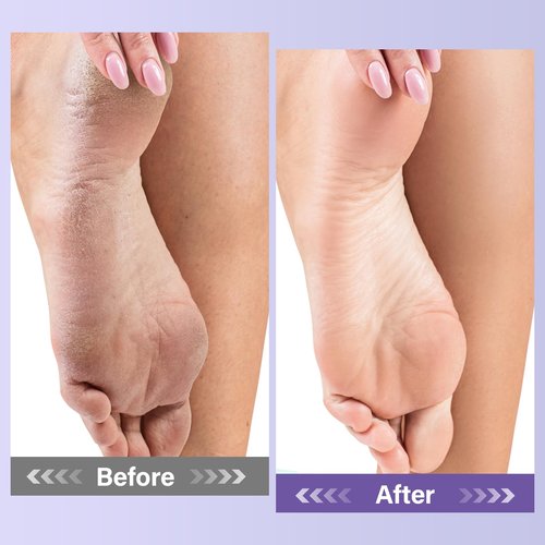 Pedicure Kit For Feet 4pcs Foot Spa Kit For Christmas Birthday Valentine's Women Men Gift Lavender Feet Care Kit for Dry Cracked Foot Soak Salt Foot Callus Remover Gel Foot File Foot Cream