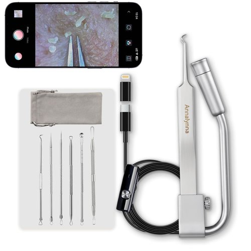 Luma 1 Visual Blackhead Remover Tweezers with Camera - Pimple Popper Tool with Camera 20x Magnification, 1080P, 8 LED Lights, with Blackhead Remover Pimple Popper Tool Kit (6 Piece Kit)