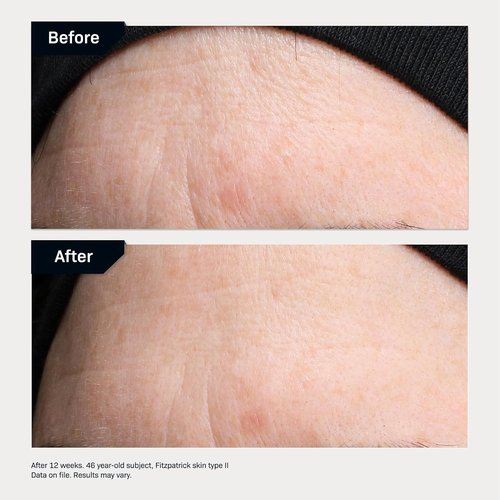 Revision Skincare Revox™ Line Relaxer - Targeted Under Eye Serum with Hyaluronic Acid for Fine Lines & Wrinkles