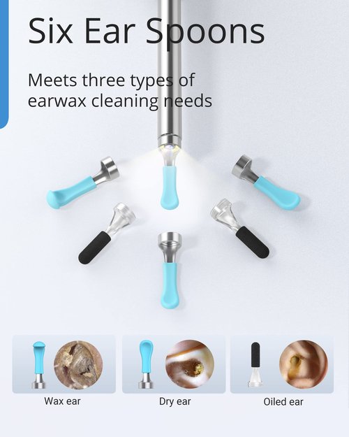 BEBIRD R1 Wax Removal Tool for Ear - Spade Ear Canal Cleaner with Camera 1080P Earscope, Wax Remove Ear Picker with Vari Replacement Tips, Camera with 6LED Light for Ear/Nose/Throat Examination, Blue