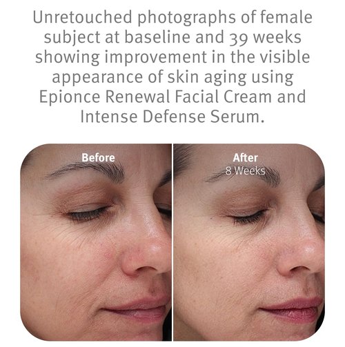 Epionce Renewal Facial Cream - Hydrating Anti-Aging Moisturizer for Sensitive Skin | Reduces Fine Lines & Wrinkles