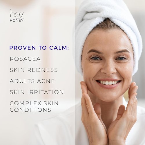 Hey Honey Skincare Relax - Instant Rosacea Relief Cream for Sensitive Skin | Calming Moisturizer with Honey & Propolis | 2.2 Oz