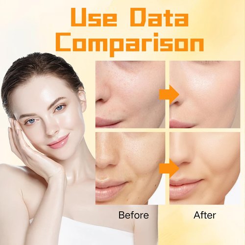 Skincare Set Vitamin C Girls Gifts - Skin Care Set Antioxidant - Hydrating Skin Care Kit for Women with Sunscreen,Toner,Serum,Eye Cream - Skin Care for Teens 10-12 (One Size, 8PCS Vitamin C Scent)