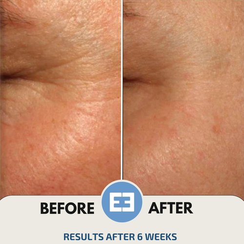 EiE 02 Klotho Peptide Cream Face Moisturizer – Rare Groundbreaking Peptides Face Cream for Women with Hyaluronic Acid, Sagging Skin, Fine Lines and Wrinkles Treatment, Made in Sweden, 1.7 fl. Oz