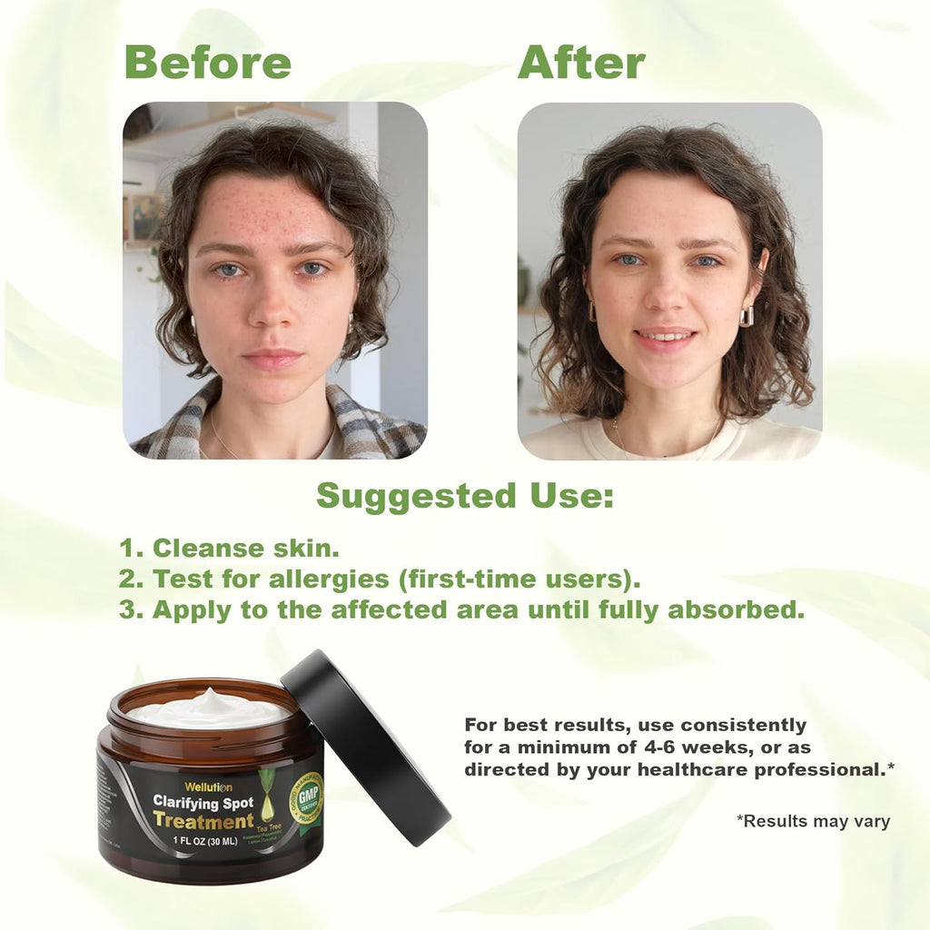 WELLUTION Cystic Acne Spot Treatment - Fast-Acting Tea Tree Cream for Pimples & Blemishes - 1oz Non-Greasy Formula