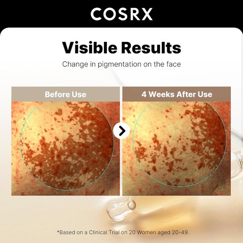COSRX 2% Alpha Arbutin Face Serum - Dark Spot & Uneven Tone Treatment with Niacinamide, 1.7 fl oz