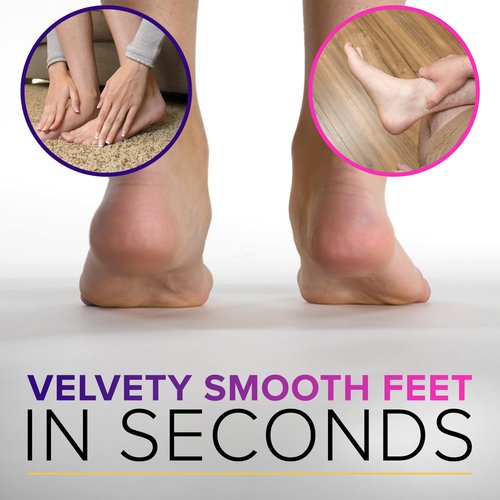 RUSTPROOF Foot File Callus Remover for Feet with Skin Catcher (XL Size) NYK1 MEGAFILE Foot Callus Remover for Wet & Dry Use - High-Performance Feet Scrubber with Textured Grip for Non-Slip Control
