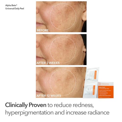 Dr. Dennis Gross Plump & Smooth Kit - DermInfusions™ Blur & Repair Cream + 5 Alpha Beta® Peels | $50 Value