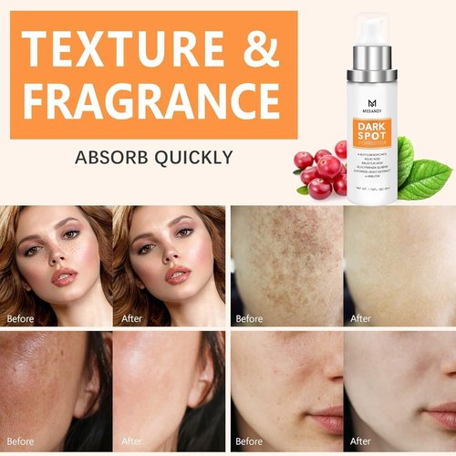 Regine Switzerland Dark Spot Remover - 5% Niacinamide Fade Cream for Sun Spots & Freckles | Anti-Aging Moisturizer for All Skin Types