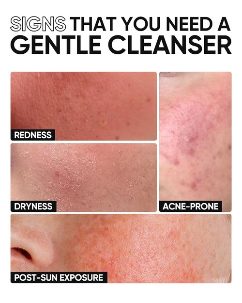 SKINTIFIC 5X Ceramide Facial Cleanser - Gentle Hydrating Daily Face Wash with Hyaluronic Acid for Dry to Normal Skin