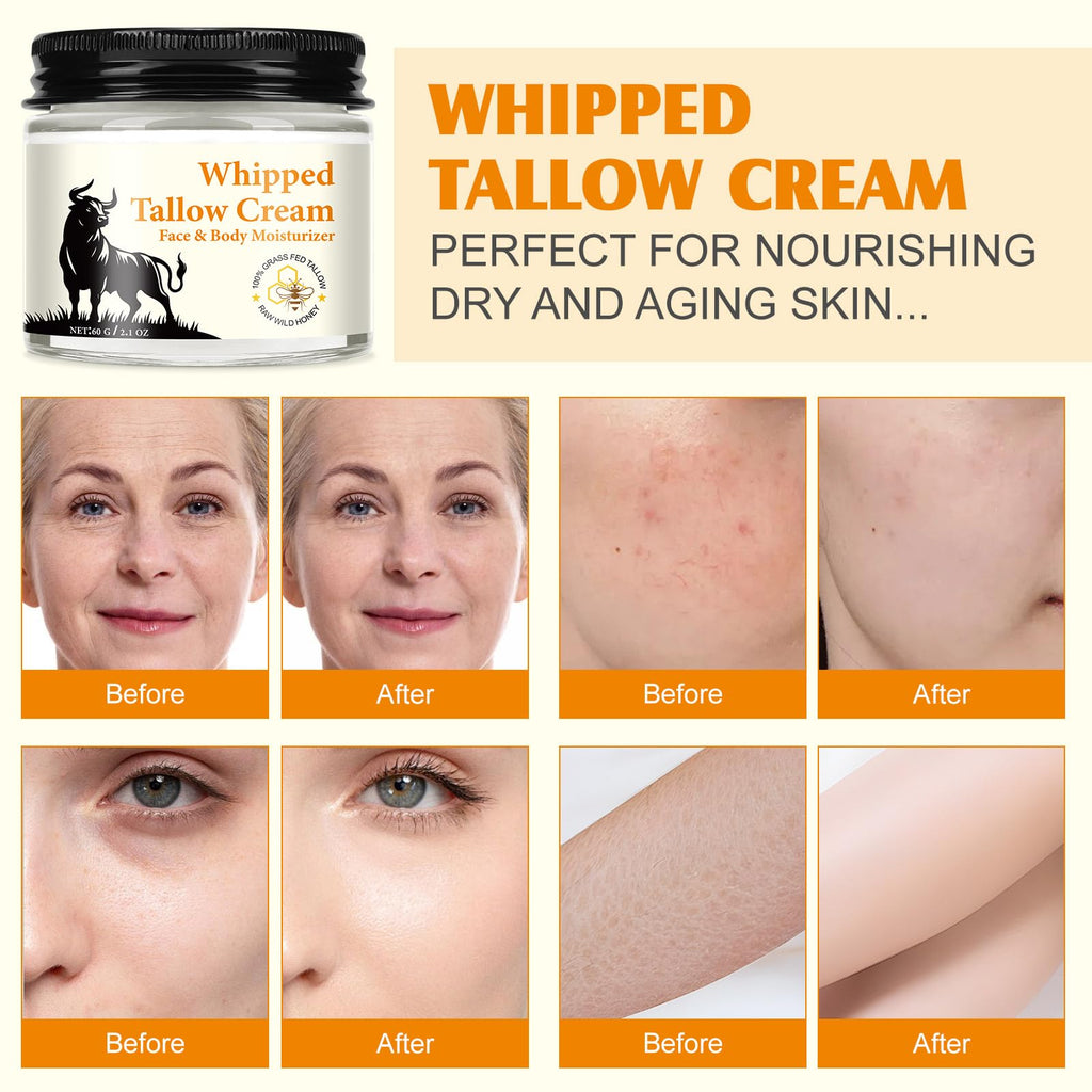WLCTJIAYOU Beef Tallow for Skin - Tallow and Honey Balm for Face - 100% Grass-Fed Beef Tallow, Honey & Beeswax, Deep Hydration for Dry & Aging Skin, Natural Barrier, Nourishing Moisturizer