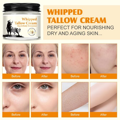 HUYEHF Beef Tallow for Skin, Beef Tallow and Honey Balm for Skin & Face Deeply Nourishing Face Body Moisturizer, for Dry Care & Anti-Aging- 60g