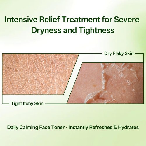 Skiennix Hydrating Facial Toner - Deep Moisturizing & Refreshing for All Skin Types | 10.1 Fl Oz & Travel Size 3.4 Fl Oz