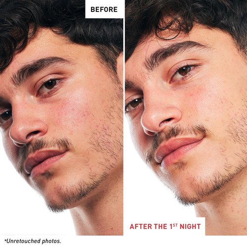 Skin Therapy Multi-Perfecting Bi-Phase Night Oil-Serum - Supercharged With 17 Ingredients -Targets 7 Skin Concerns- Improves Appearance of Fine Lines, Skin Texture and Complexion Evenness (0.3 Fl Oz)