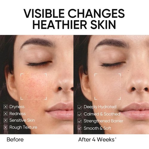 SKINTIFIC Face Moisturizer - 5X Ceramides & Hyaluronic Acid for Sensitive/Oily Skin | 30g/1 fl. oz