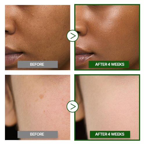 GOODAL Green Tangerine Vitamin C Cream [Advanced Ver.] – Vitamin C Cream with 5% Niacinamide | Fades Dark Spots, Boosts Radiance & Hydrates | Korean Skincare 1.69oz / 50ml