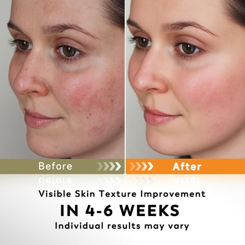 Turmeric Kojic Acid Cleansing Pads, 50 PCS Turmeric Pads for Face Dark Spots Cleansing & Exfoliation