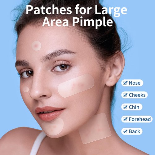 QUSTERE Large Pimple Patches for Face, Hydrocolloid Acne Patches, Big Hydrocolloid Bandages, Variety Shapes Zit Covers, Stickers with Tea Tree, Salicylic Acid & Cica Oil |8 Sizes |380 Count