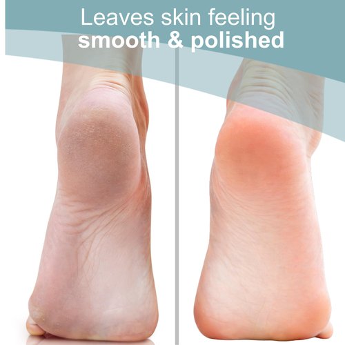 Trim Neat Feet Foot Care Implements Nano Glass Foot File, Hard Skin Remover for Feet, Manual Scraper, Callus Remover, Removes Dead Skin, Smooth Foot Health, Durable Pedicure Tool, Wet Or Dry, 1 Count