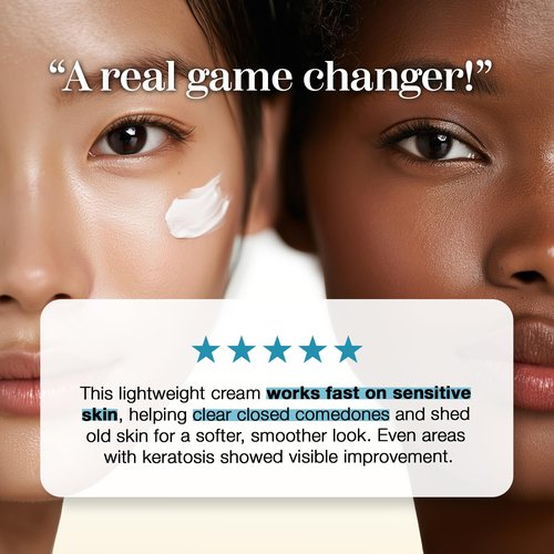 it:fu Soonyuul Cream for Closed Comedones & Acne Care | Barrier Repair Moisturizer with Niacinamide & Coix Seed (1.69 fl oz)