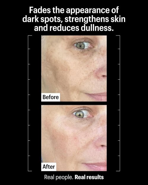 Allies of Skin Tranexamic & Arbutin Brightening Serum - Lightweight Daily Formula with Peptides | 1.6 fl oz