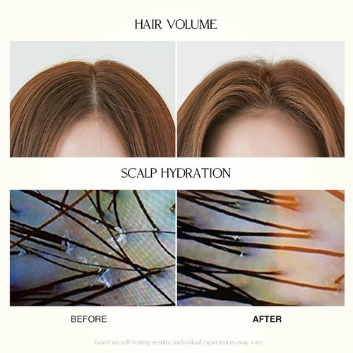 Skiennix Mild Moisture Shampoo - Hydrating & Nourishing for Normal to Dry Scalp | 16.9 fl oz