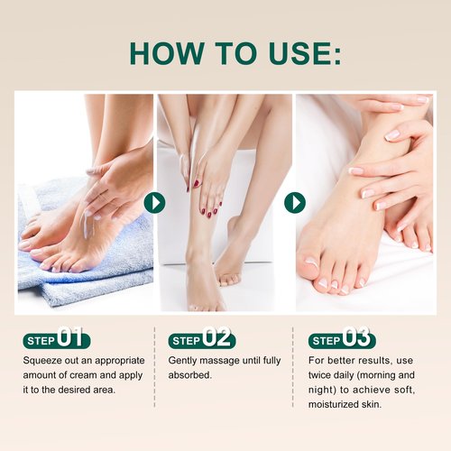 Misoour 25% Urea Hand Cream for Feet with 2% Salicylic Acid & 5% AHA+Aloe Vera, Urea Foot Cream for Dry Cracked Hands, Heels and Feet, Moisturizer and Repair for Rough Skin