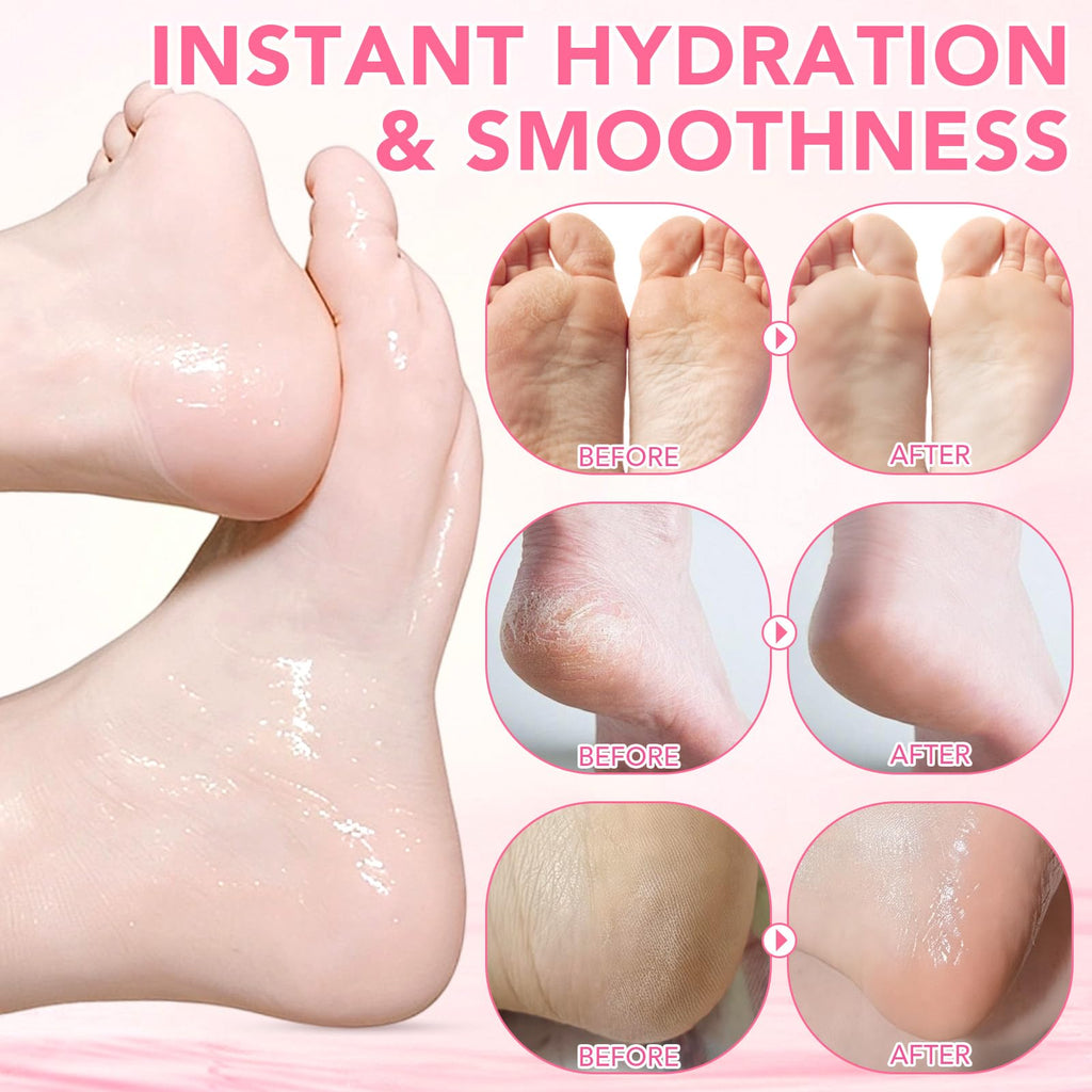 XIAMOFUZHOU 60% Urea plus 2% Salicylic Acid Foot Care Stick, Deep Hydration Soften & Smooth Thickened Areas, Intensive Moisturizer Repairs for Dry, Cracked Heels & Thickened Skin (1.41 Ounce, Peach)