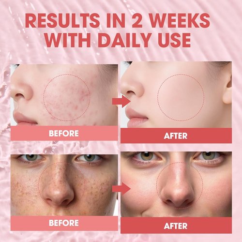PDRN Pink Glow Serum - Hydrating Korean Glass Skin Serum with Peptides & Niacinamide | 1.01 fl. Oz
