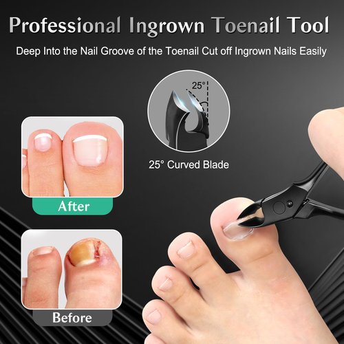 LEYOUFU Toenail Clippers for Seniors Thick Nails, Professional Ingrown Toe Nail Clippers Tools, Wide Jaw Opening Finger Nail Cutter 5-in-1 Heavy Duty Nail Clipper Kit Gifts for Men & Women Adult