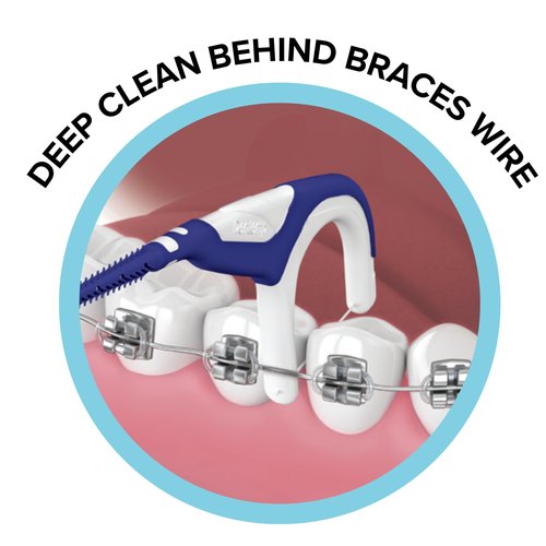 OrVance Braces Flosser - Designed for Braces for an Easy & Effective Clean, Ultra Strong Floss - 40 Count (Pack of 2) - (Packaging May Vary)
