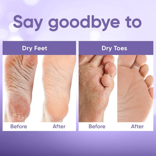 CÉLOR Foot Peeling Mask for Dry Cracked Feet | Foot Mask to Exfoliate Rough, Cracked, Dry Feet, Calluses for Soft Baby Feet Results | Made with Aloe Vera Extract for Women & Men (5 Pairs) | Lavender