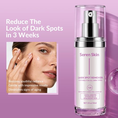Dark Spot Remover for Face and Body, Dark Spot Corrector for Melasma, Acne Scars, Sun Spots and Age Spots, Hyperpigmentation Treatment Vitamin C Dark Spot Correcting Glow Serum, 1.0 fl oz