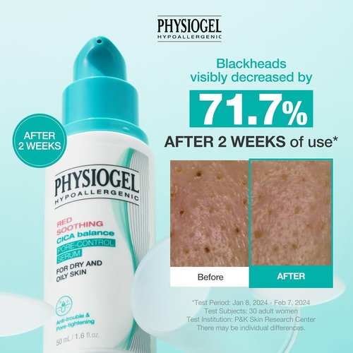 Physiogel Red Soothing CICA Balance Serum - Niacinamide Pore Control & Exfoliant | 1.69 fl. oz